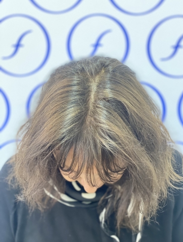 Antes