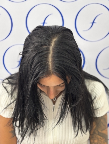 Antes