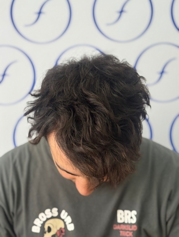 Antes