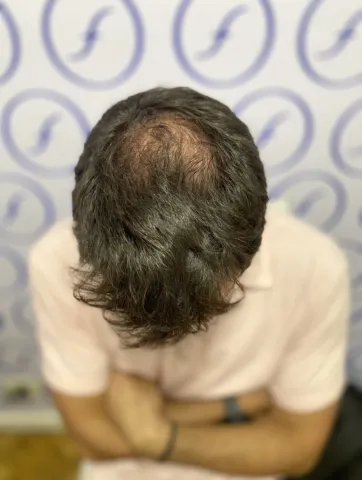 Antes